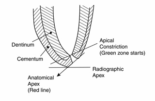 Apical Diagram